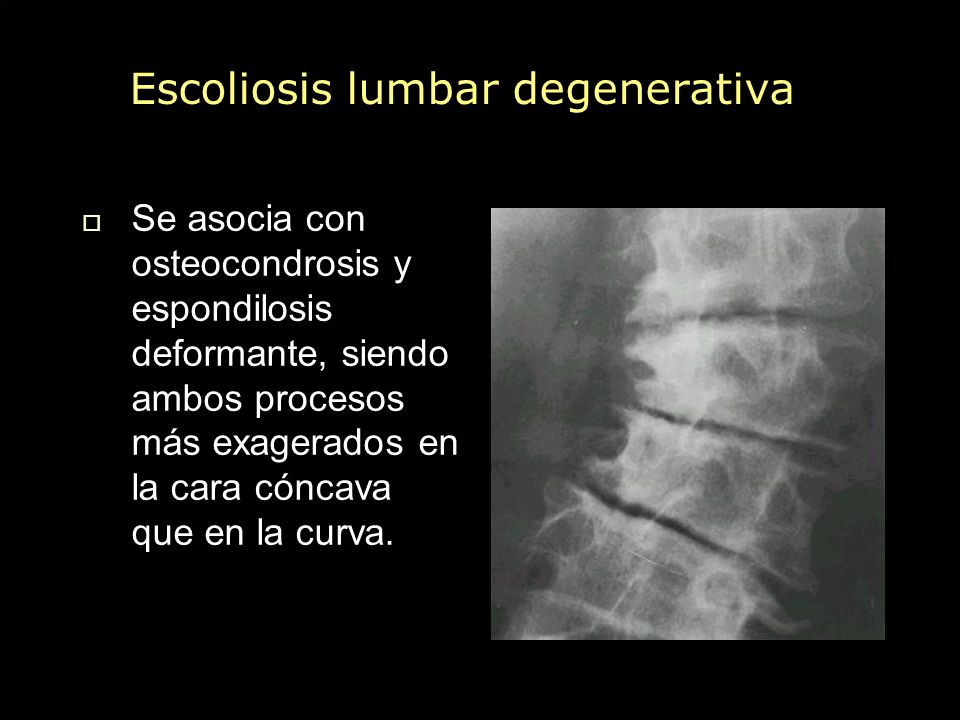 Que calmar el dolor sheynogo del departamento